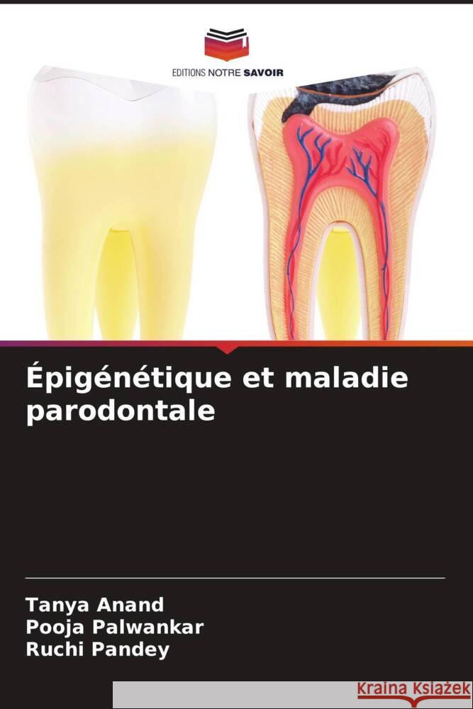 Épigénétique et maladie parodontale Anand, Tanya, Palwankar, Pooja, Pandey, Ruchi 9786204610726 Editions Notre Savoir - książka