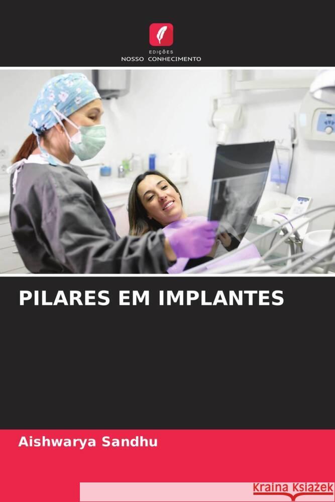 Pilares Em Implantes Aishwarya Sandhu 9786208221140 Edicoes Nosso Conhecimento - książka