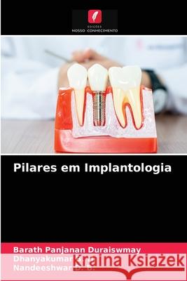 Pilares em Implantologia Duraiswmay, Barath Panjanan, B. H., Dhanyakumar, D. B., Nandeeshwar 9786203241372 Edicoes Nosso Conhecimento - książka