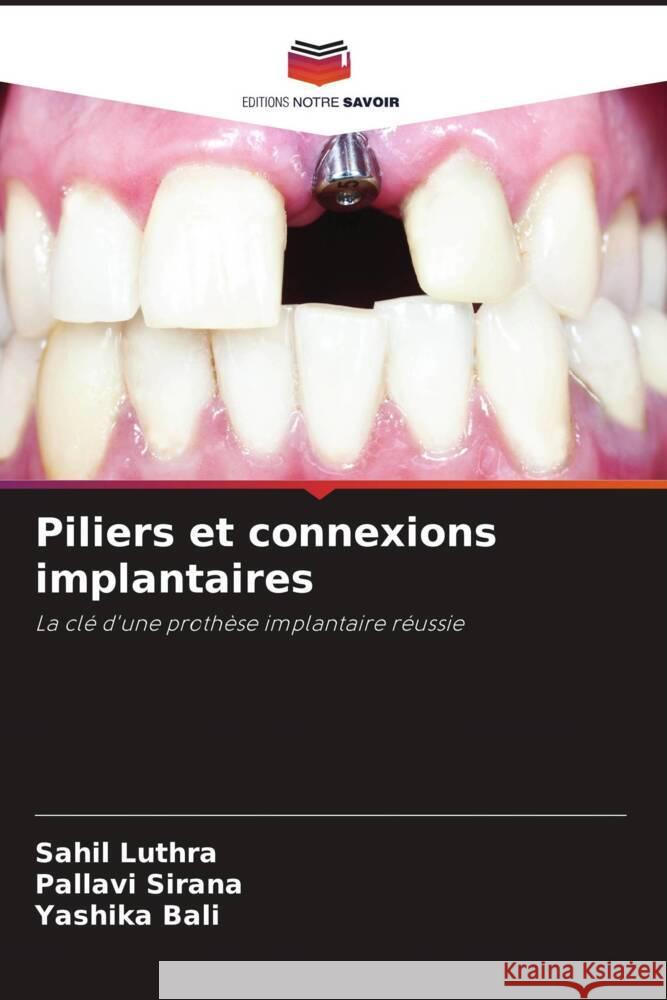 Piliers et connexions implantaires Luthra, Sahil, Sirana, Pallavi, Bali, Yashika 9786204629186 Editions Notre Savoir - książka