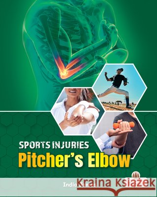 Pitcher's Elbow India James 9781039880818 Crabtree Forest - książka