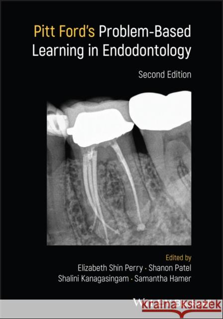 Pitt Ford's Problem-Based Learning in Endodontology Patel, Shanon 9781119565970 John Wiley and Sons Ltd - książka