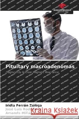 Pituitary macroadenomas Iridia Ferran Zuniga Jose Luis Rodriguez Amanda Milian Ferran 9786205859766 Our Knowledge Publishing - książka