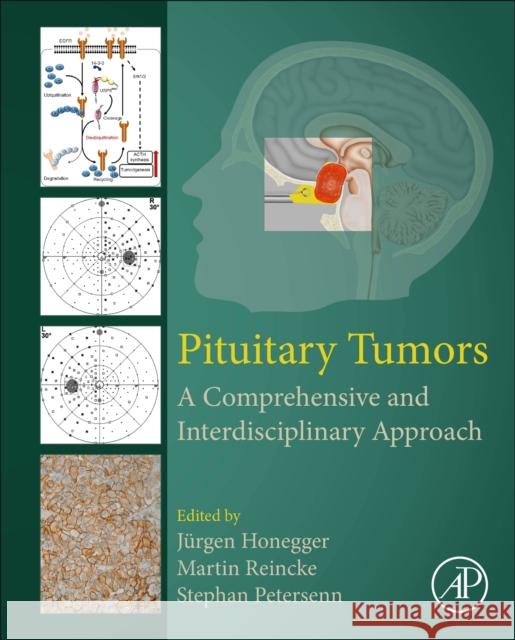 Pituitary Tumors: A Comprehensive and Interdisciplinary Approach J Honegger Martin Reincke Stephan Petersenn 9780128199497 Elsevier Science Publishing Co Inc - książka