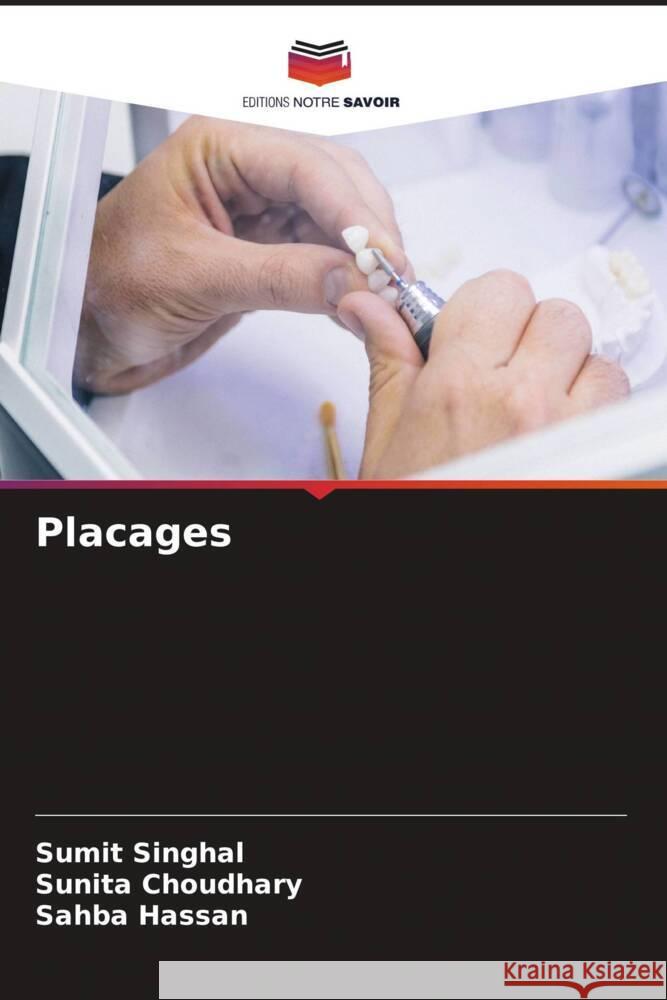 Placages SINGHAL, SUMIT, Choudhary, Sunita, Hassan, Sahba 9786208317102 Editions Notre Savoir - książka