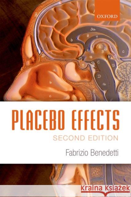 Placebo Effects: Understanding the Mechanisms in Health and Disease Fabrizio Benedetti 9780198705086 Oxford University Press, USA - książka