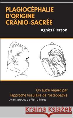 plagiocéphalie d'origine crânio-sacrée: un autre regard par l'approche tissulaire de l'ostéopathie Pierson, Agnès 9782322260638 Books on Demand - książka