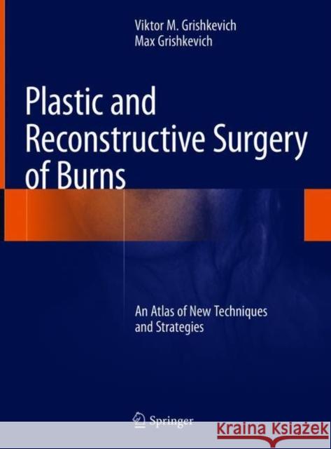 Plastic and Reconstructive Surgery of Burns: An Atlas of New Techniques and Strategies Grishkevich, Viktor M. 9783319787138 Springer - książka