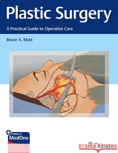 Plastic Surgery: A Practical Guide to Operative Care Mast, Bruce A. 9781626232587 Thieme Medical Publishers - książka