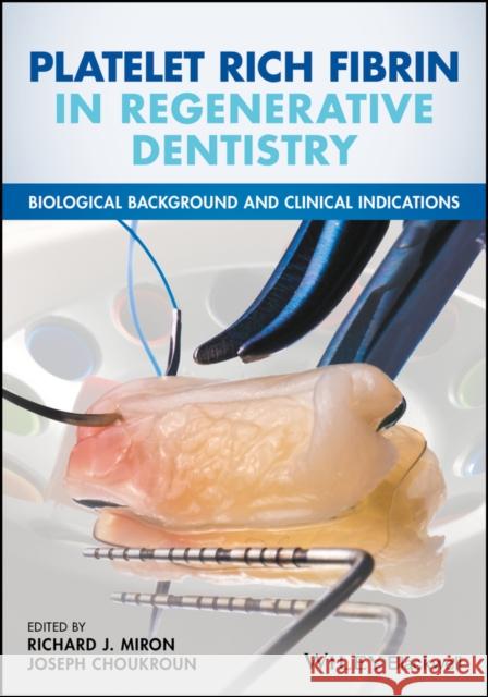 Platelet Rich Fibrin in Regenerative Dentistry: Biological Background and Clinical Indications Miron, Richard 9781119406815 John Wiley & Sons - książka