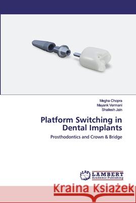 Platform Switching in Dental Implants Chopra, Megha 9786200456687 LAP Lambert Academic Publishing - książka