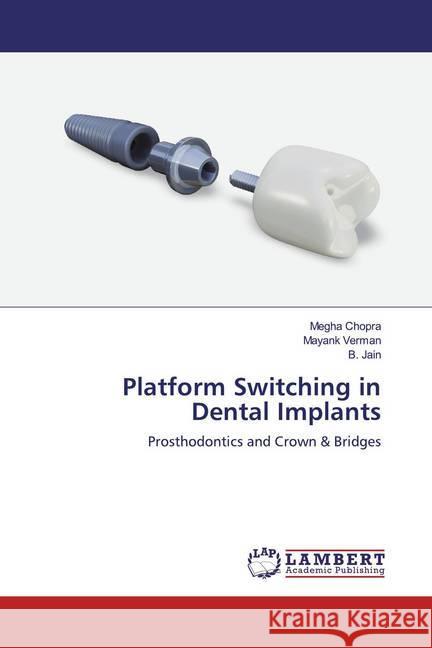 Platform Switching in Dental Implants : Prosthodontics and Crown & Bridges Chopra, Megha; Vermani, Mayank; Jain, Shailesh 9786200549440 LAP Lambert Academic Publishing - książka