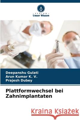 Plattformwechsel bei Zahnimplantaten Gulati, Deepanshu, K. V., Arun Kumar, Dubey, Prajesh 9786202376990 Verlag Unser Wissen - książka