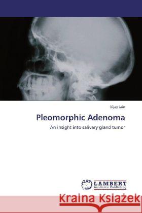 Pleomorphic Adenoma : An insight into salivary gland tumor Jain, Vijay 9783659177477 LAP Lambert Academic Publishing - książka