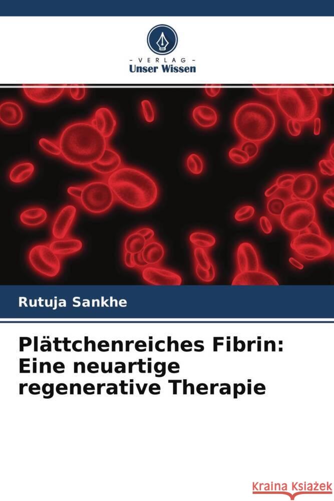 Pl?ttchenreiches Fibrin: Eine neuartige regenerative Therapie Rutuja Sankhe Amit Agrawal 9786204609355 Verlag Unser Wissen - książka