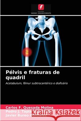 Pélvis e fraturas de quadril Carlos F Quesada Molina, Pedro J Tapia Fernández, Javier Bureo González 9786203641134 Edicoes Nosso Conhecimento - książka