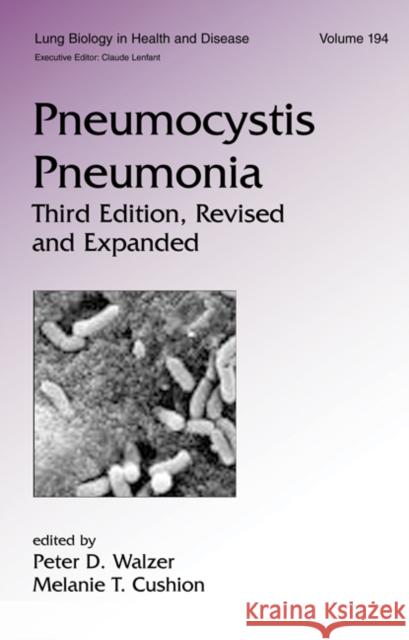Pneumocystis Pneumonia Walzer                                   Walzer Walzer Peter D. Walzer 9780824754518 Informa Healthcare - książka