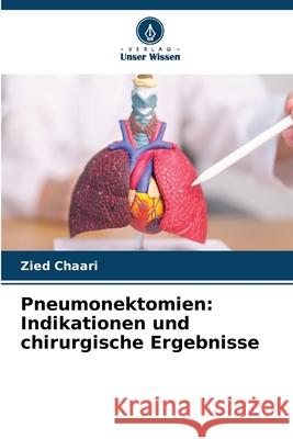 Pneumonektomien: Indikationen und chirurgische Ergebnisse Chaari, Zied 9786208700294 Verlag Unser Wissen - książka