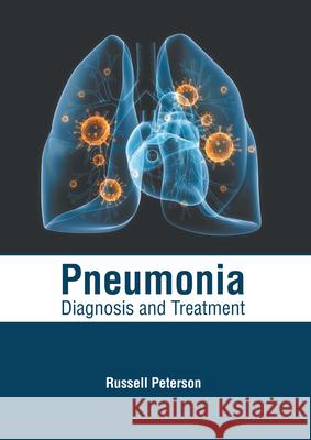 Pneumonia: Diagnosis and Treatment Russell Peterson 9781632418623 Hayle Medical - książka