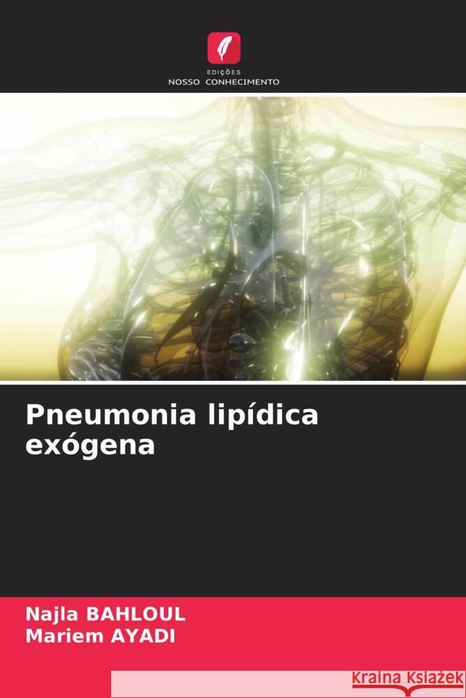 Pneumonia lipídica exógena BAHLOUL, Najla, AYADI, Mariem 9786207955046 Edições Nosso Conhecimento - książka