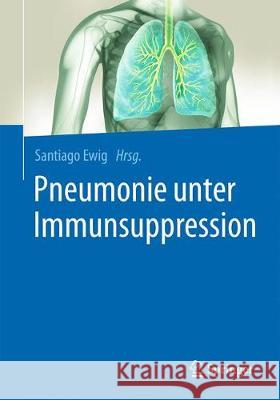 Pneumonie Unter Immunsuppression Ewig, Santiago 9783662557402 Springer, Berlin - książka