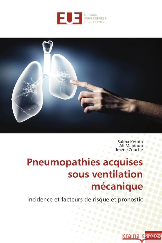 Pneumopathies acquises sous ventilation mécanique Ketata, Salma, Majdoub, Ali, Zouche, Imene 9786138494126 Éditions universitaires européennes - książka