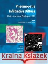 Pneumopatie Infiltrative Diffuse: Clinica, Anatomia Patologica, Hrtc Maffessanti, M. 9788847002746 Springer - książka