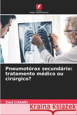 Pneumotórax secundário: tratamento médico ou cirúrgico? Chaari, Zied 9786209307287 Edições Nosso Conhecimento - książka