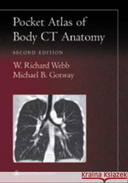 Pocket Atlas of Body CT Anatomy Michael B. Gotway 9780781736633 Lippincott Williams and Wilkins - książka