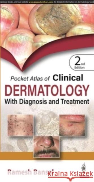 Pocket Atlas of Clinical Dermatology with Diagnosis and Treatment Ramesh Bansal   9789354655937 Jaypee Brothers Medical Publishers - książka