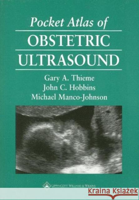 Pocket Atlas of Obstetric Ultrasound G A Thieme 9780397516230 Lippincott Williams and Wilkins - książka