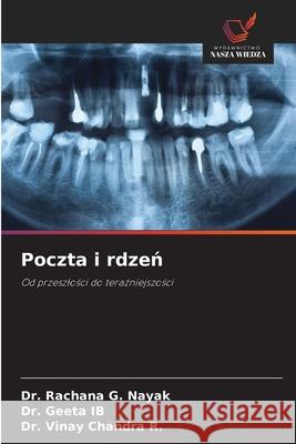 Poczta i rdzen Nayak, Dr. Rachana G., IB, DR. GEETA, R., Dr. Vinay Chandra 9786208714413 Wydawnictwo Nasza Wiedza - książka