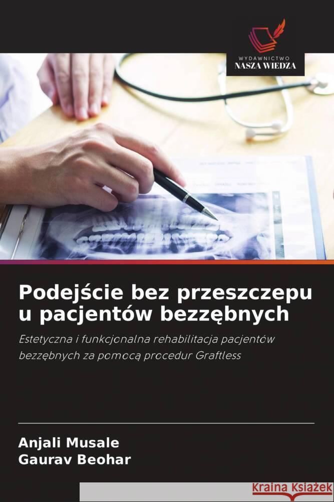 Podejscie bez przeszczepu u pacjentów bezzebnych Musale, Anjali, Beohar, Gaurav 9786208570903 Wydawnictwo Nasza Wiedza - książka
