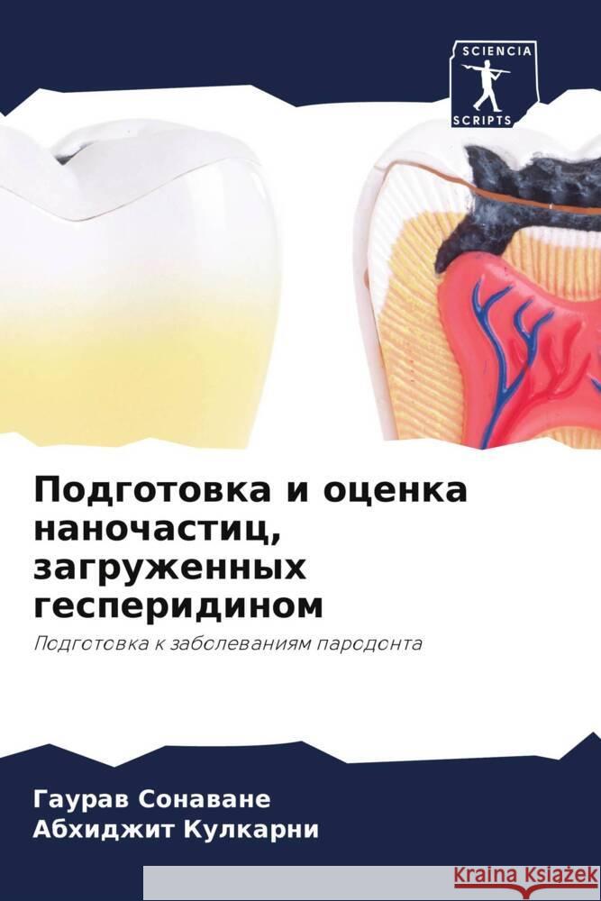 Podgotowka i ocenka nanochastic, zagruzhennyh gesperidinom Sonawane, Gauraw, Kulkarni, Abhidzhit 9786205596630 Sciencia Scripts - książka