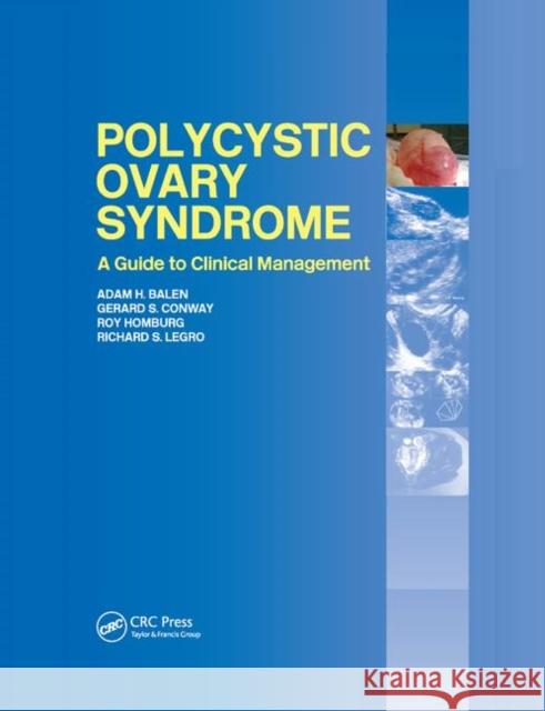 Polycystic Ovary Syndrome: A Guide to Clinical Management Adam H. Balen Gerard Conway Roy Homburg 9780367392864 CRC Press - książka