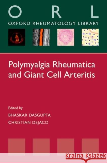 Polymyalgia Rheumatica and Giant Cell Arteritis Bhaskar Dasgupta 9780198729204 OXFORD UNIVERSITY PRESS ACADEM - książka