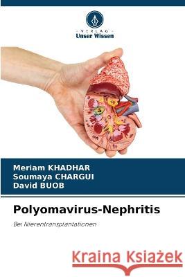 Polyomavirus-Nephritis Meriam Khadhar Soumaya Chargui David Buob 9786205665596 Verlag Unser Wissen - książka