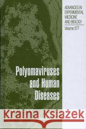 Polyomaviruses and Human Diseases Nasimul Ahsan 9781441921222 Springer - książka