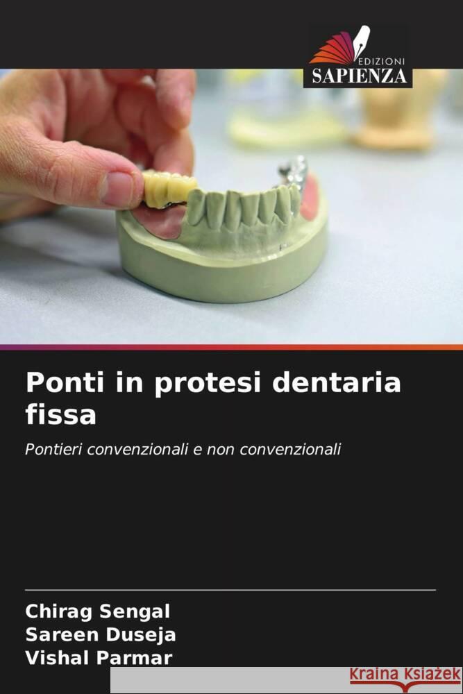 Ponti in protesi dentaria fissa Sengal, Chirag, Duseja, Sareen, Parmar, Vishal 9786204768700 Edizioni Sapienza - książka