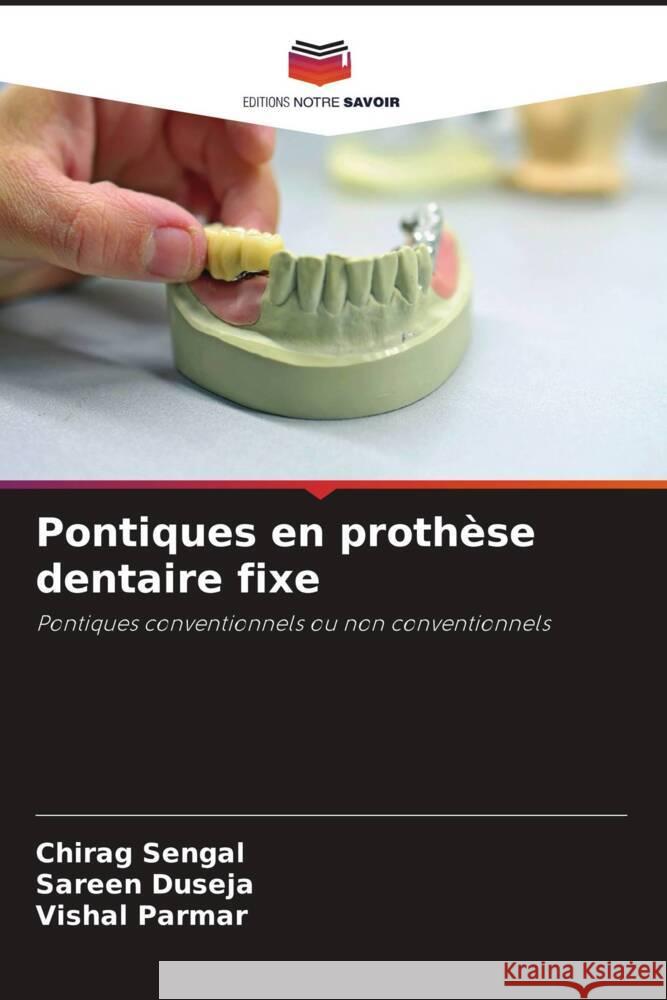 Pontiques en prothèse dentaire fixe Sengal, Chirag, Duseja, Sareen, Parmar, Vishal 9786204768694 Editions Notre Savoir - książka