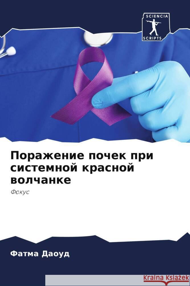 Porazhenie pochek pri sistemnoj krasnoj wolchanke Daoud, Fatma, Somai, Mehdi, Rakhdi, Imene 9786204433998 Sciencia Scripts - książka