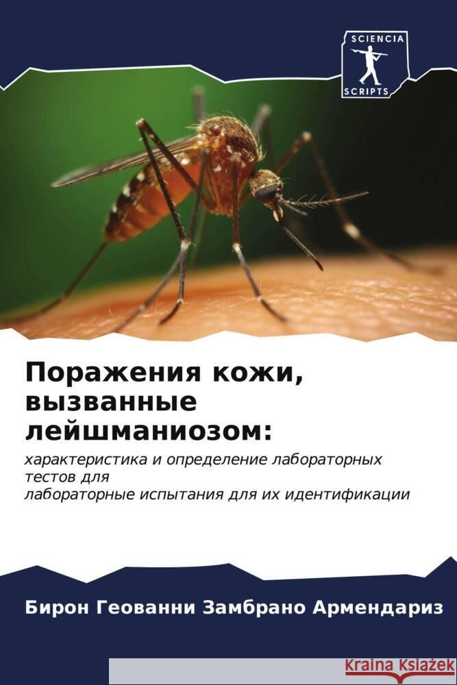 Porazheniq kozhi, wyzwannye lejshmaniozom: Zambrano Armendariz, Biron Geowanni 9786206536222 Sciencia Scripts - książka
