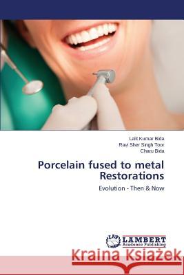 Porcelain fused to metal Restorations Bida Lalit Kumar 9783659240423 LAP Lambert Academic Publishing - książka