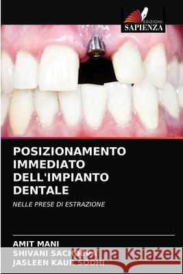 Posizionamento Immediato Dell'impianto Dentale Amit Mani Shivani Sachdeva Jasleen Kaur Sodhi 9786203216486 Edizioni Sapienza - książka