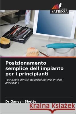 Posizionamento semplice dell'impianto per i principianti Shetty, Dr Ganesh 9786200712851 Edizioni Sapienza - książka