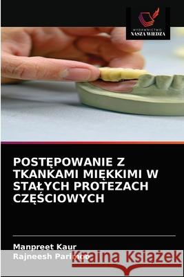 PostĘpowanie Z Tkankami MiĘkkimi W Stalych Protezach CzĘŚciowych Manpreet Kaur, Rajneesh Parimoo 9786203609561 Wydawnictwo Nasza Wiedza - książka