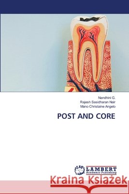 Post and Core Nandhini G Rajesh Sasidhara Mano Christain 9786207653676 LAP Lambert Academic Publishing - książka