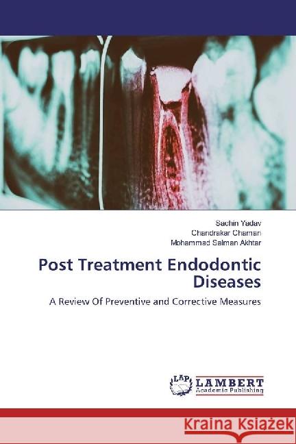 Post Treatment Endodontic Diseases : A Review Of Preventive and Corrective Measures Yadav, Sachin; Chaman, Chandrakar; Akhtar, Mohammad Salman 9786202075633 LAP Lambert Academic Publishing - książka