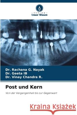 Post und Kern Nayak, Dr. Rachana G., IB, DR. GEETA, R., Dr. Vinay Chandra 9786208714369 Verlag Unser Wissen - książka