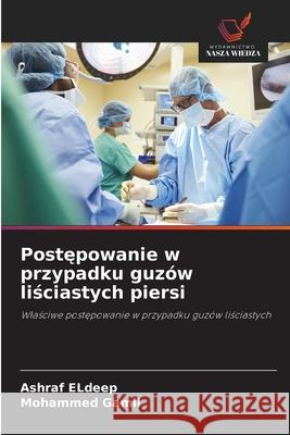 Postepowanie w przypadku guzów lisciastych piersi Eldeep, Ashraf, Gamil, Mohammed 9786209254611 Wydawnictwo Nasza Wiedza - książka